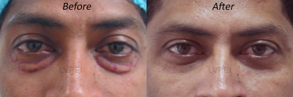 Ophthalmic Plastic and Facial Aesthetic Surgery Services